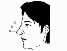 <a href='http://www.dytaisa.com/article/201407/29/11940.shtml'>鼻梁起节克夫鼻</a>